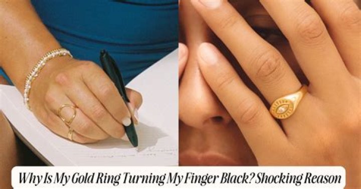 Why is my 14K gold ring turning my finger black?